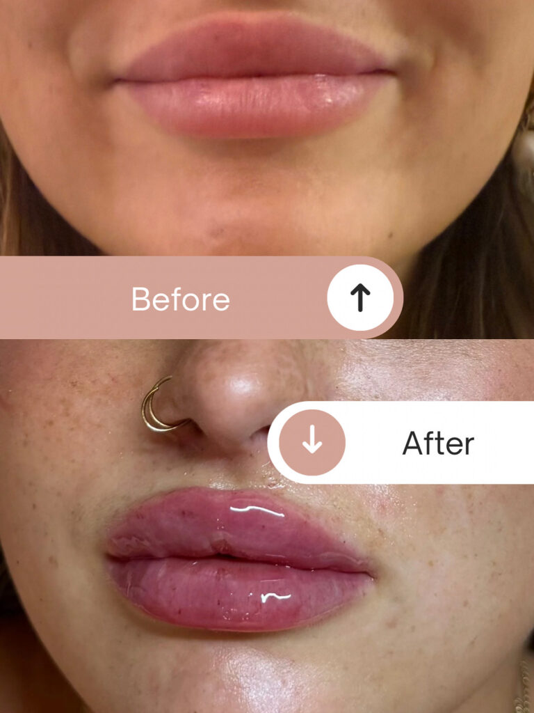 Before & After