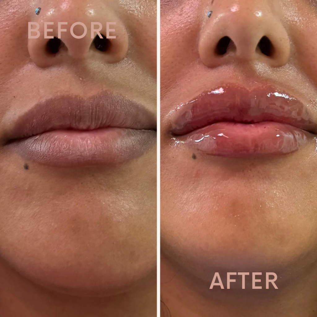 Before & After