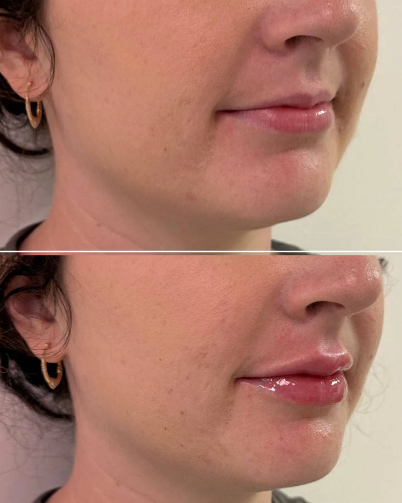 Before & After