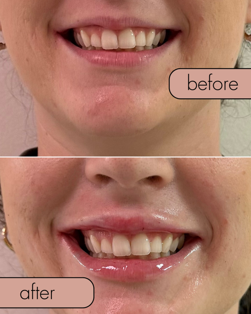 Before & After