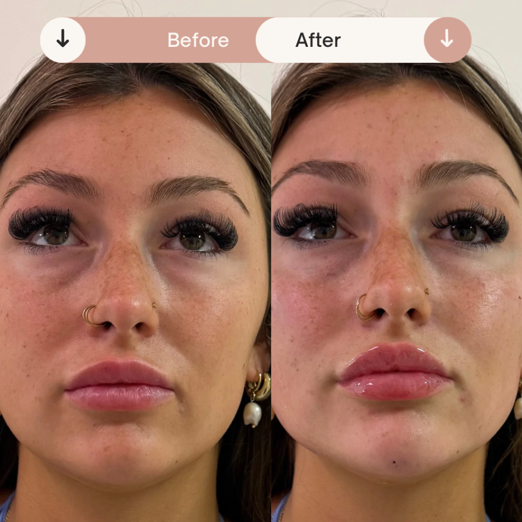 Before & After