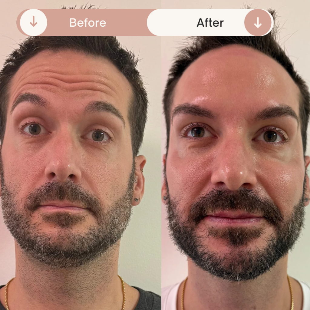 Before & After