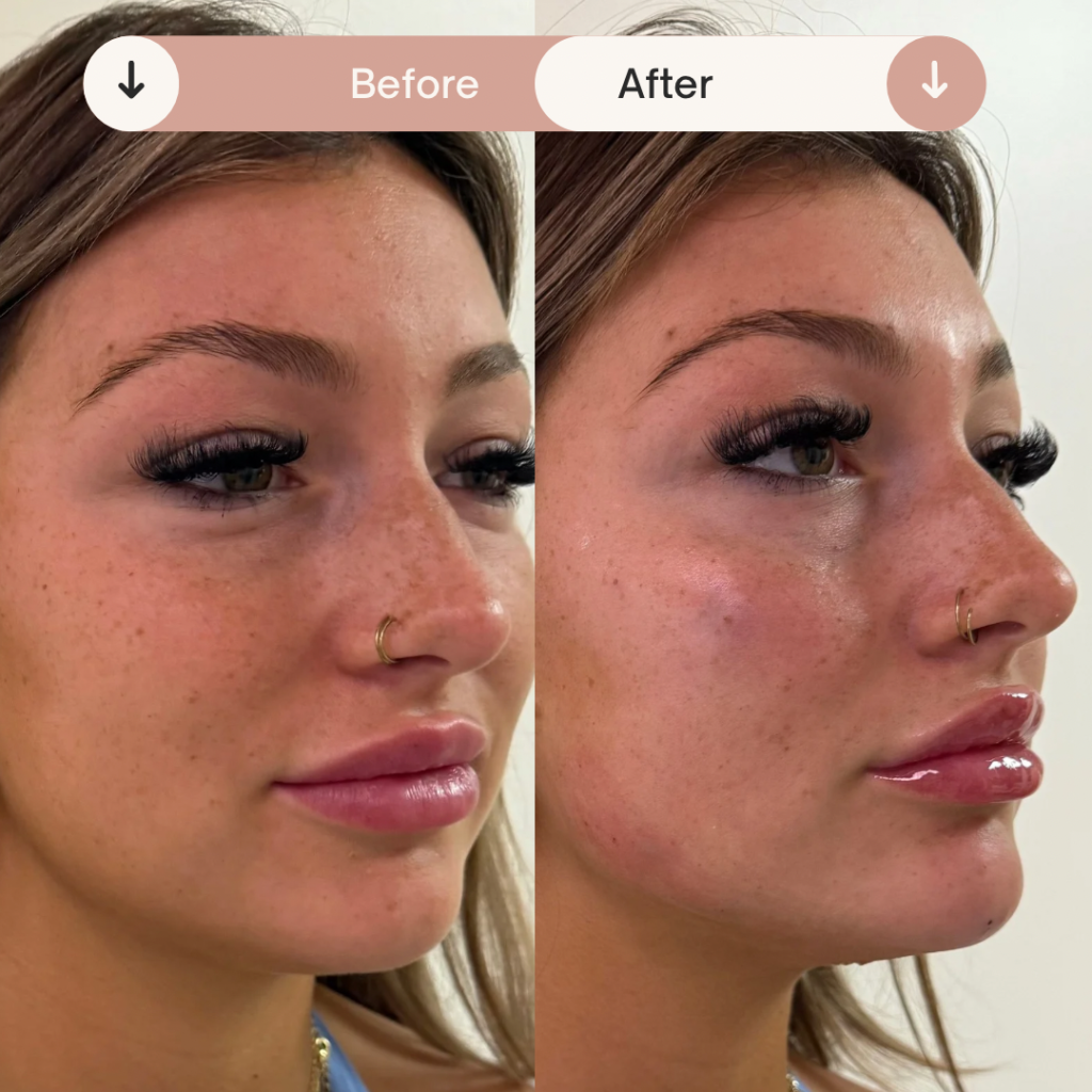 Before & After