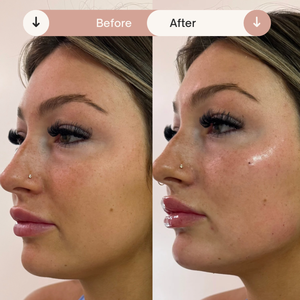 Before & After