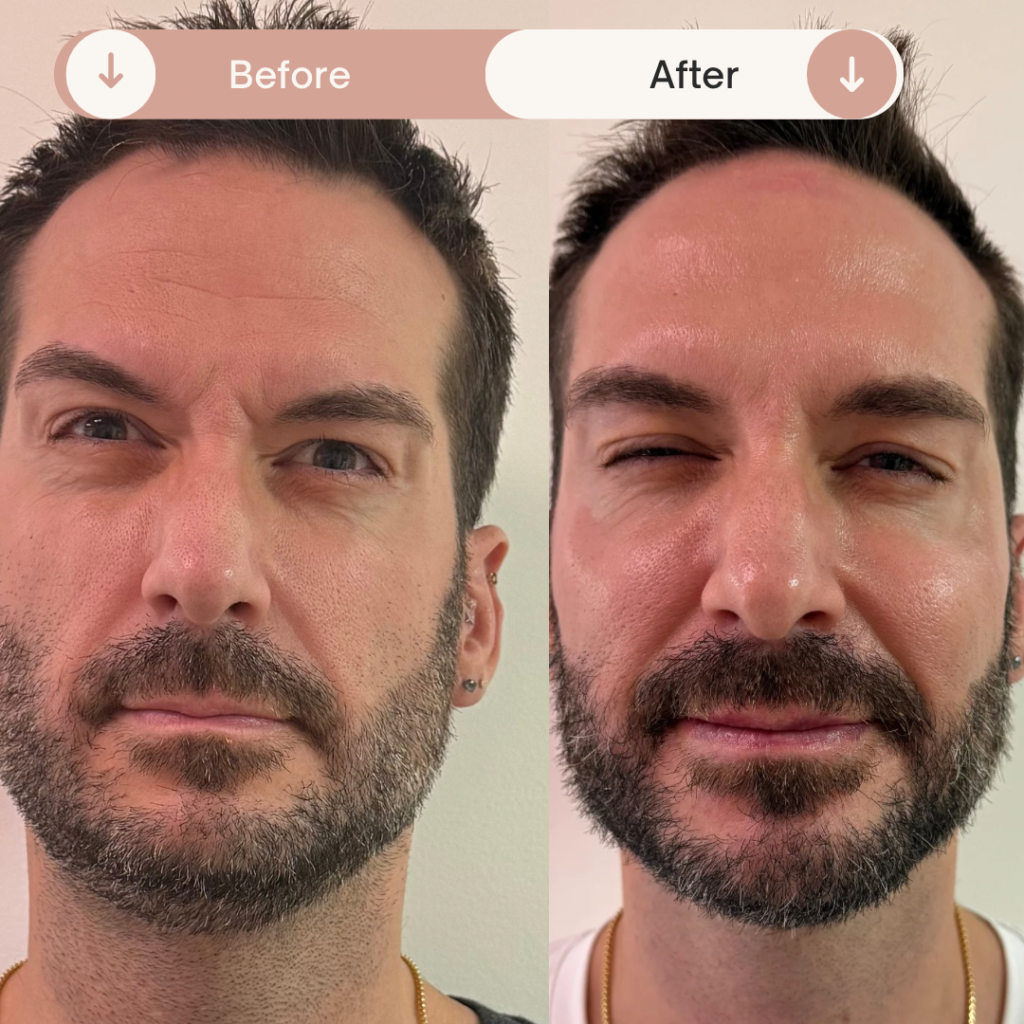 Before & After