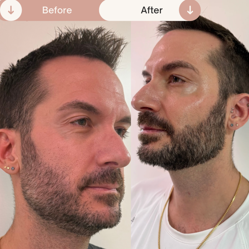 Before & After