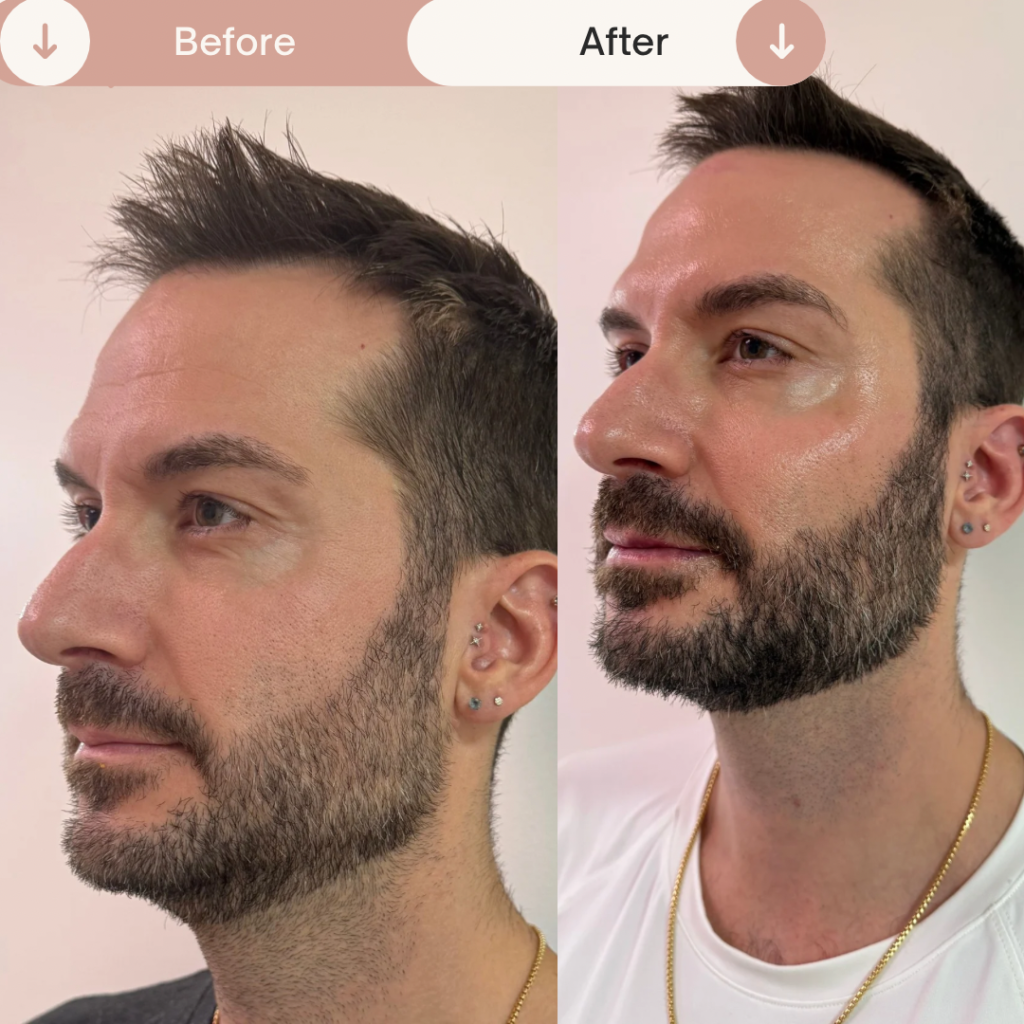 Before & After