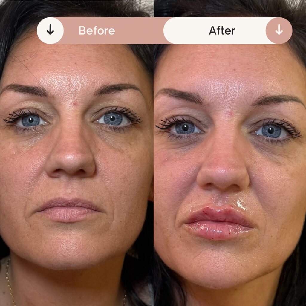 Before & After