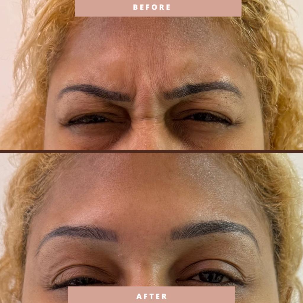 Before & After