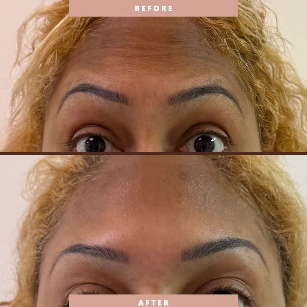 Before & After