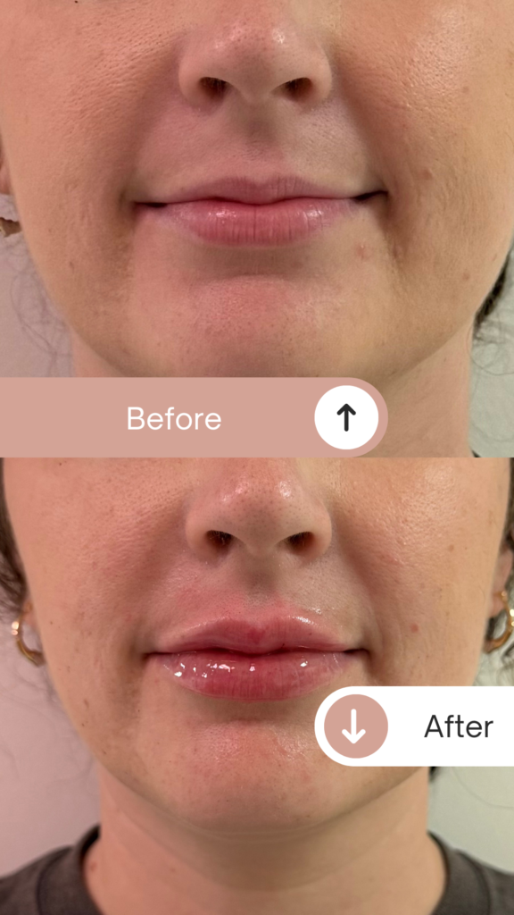 Before & After