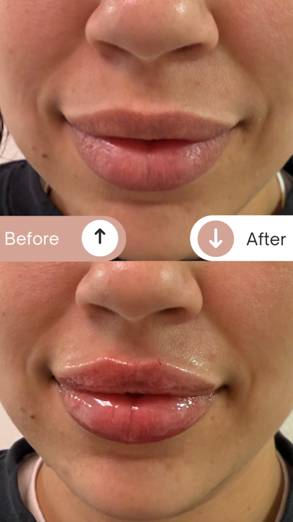 Before & After