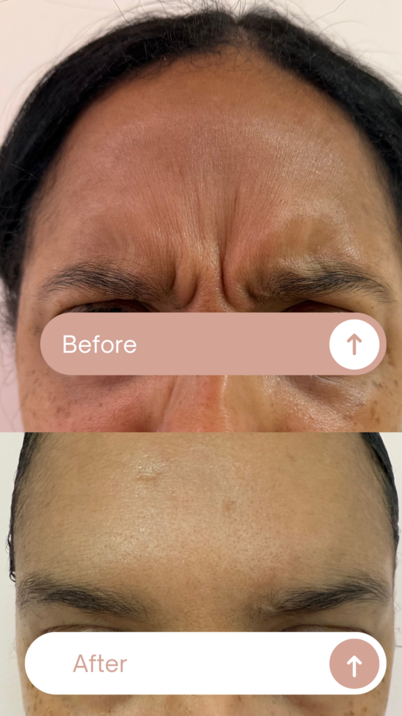 Before & After