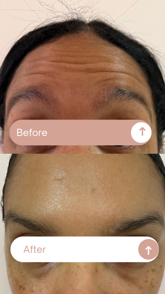 Before & After