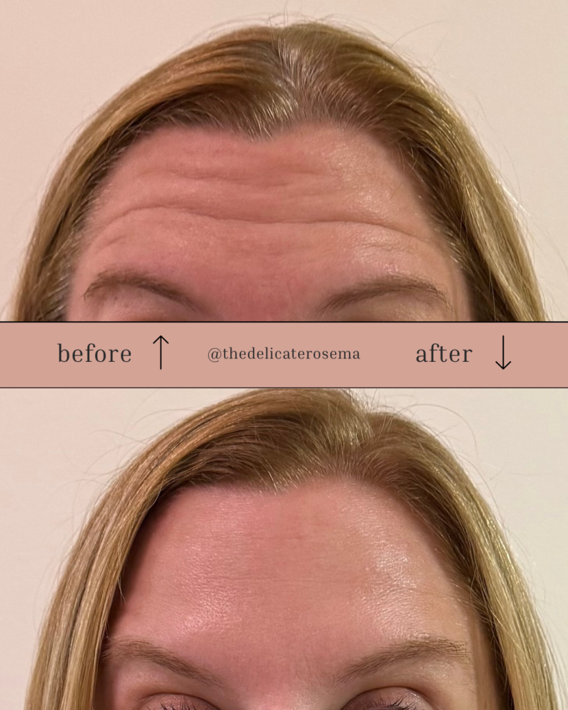 Before & After