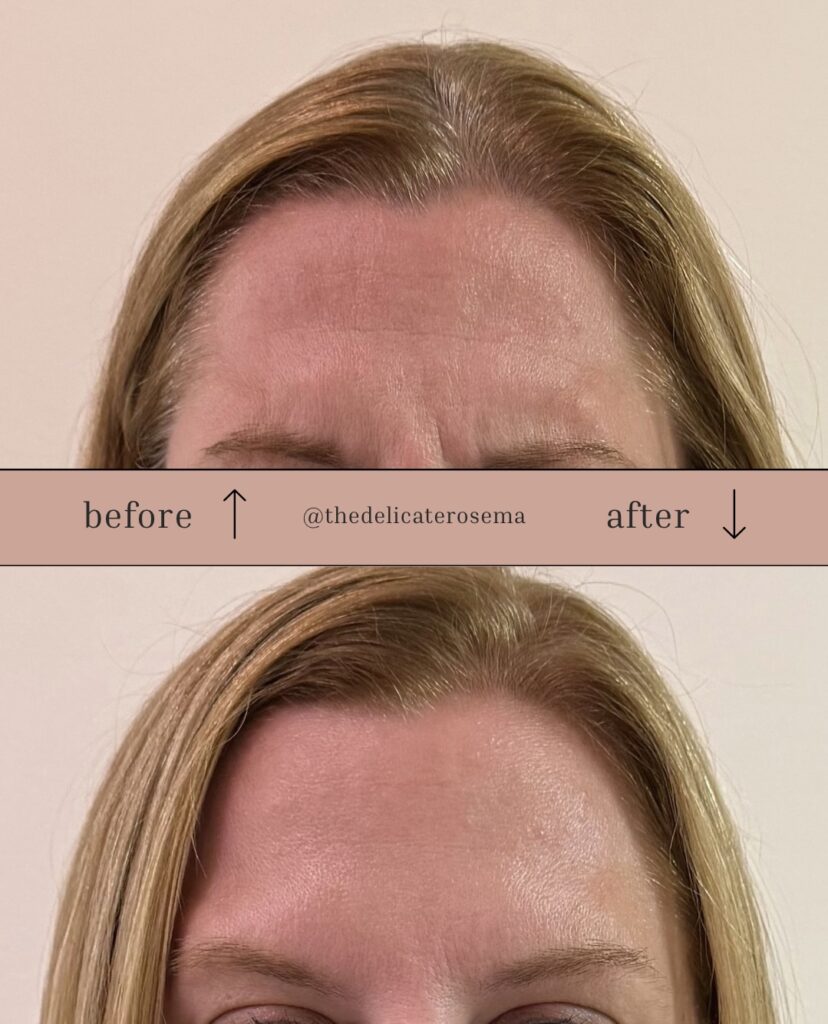 Before & After