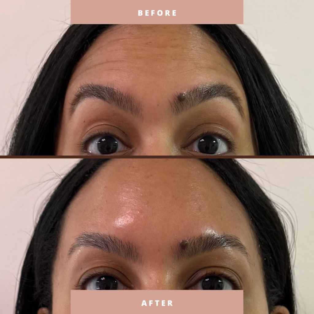 Before & After