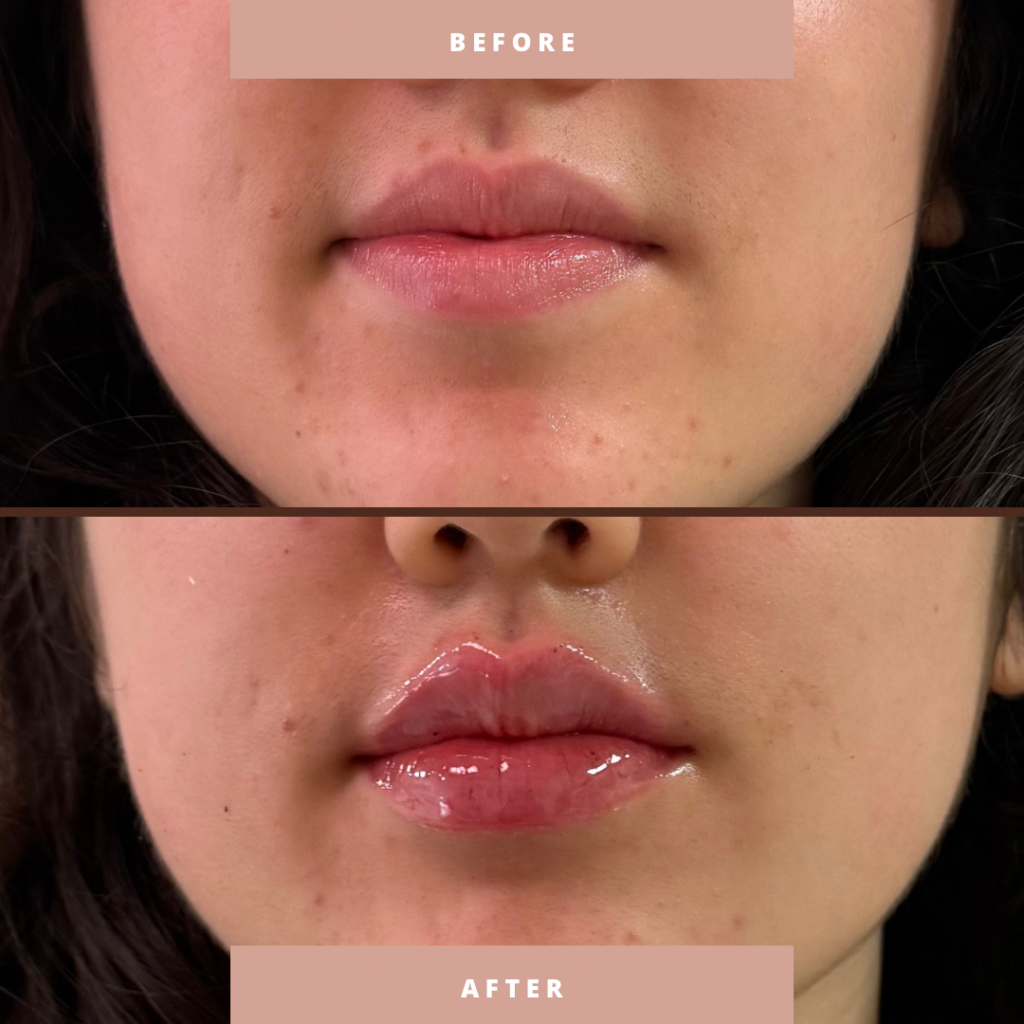 Before & After