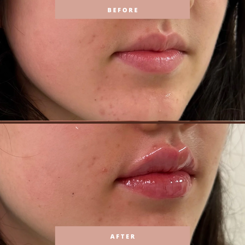 Before & After