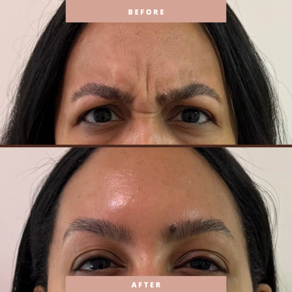 Before & After