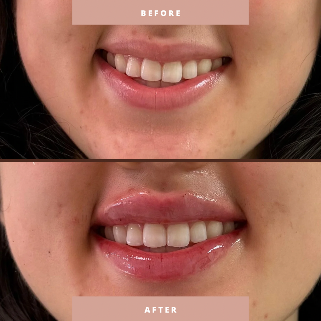 Before & After